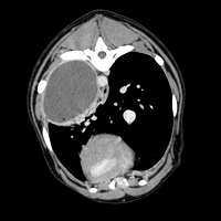 00018600_00034600_DICOM_CT_2010_10_11_0000473751_klein